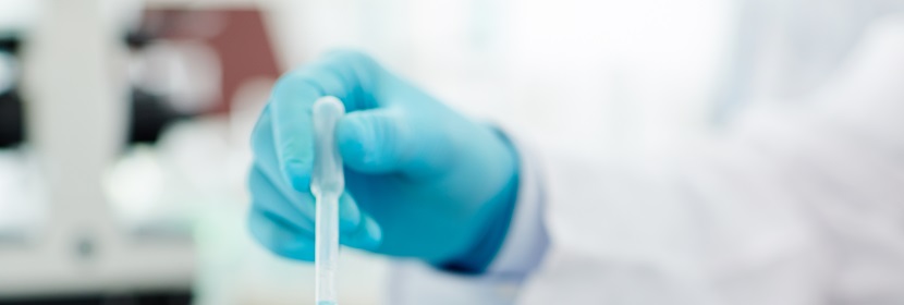 環氧乙烯基酯樹脂檢測